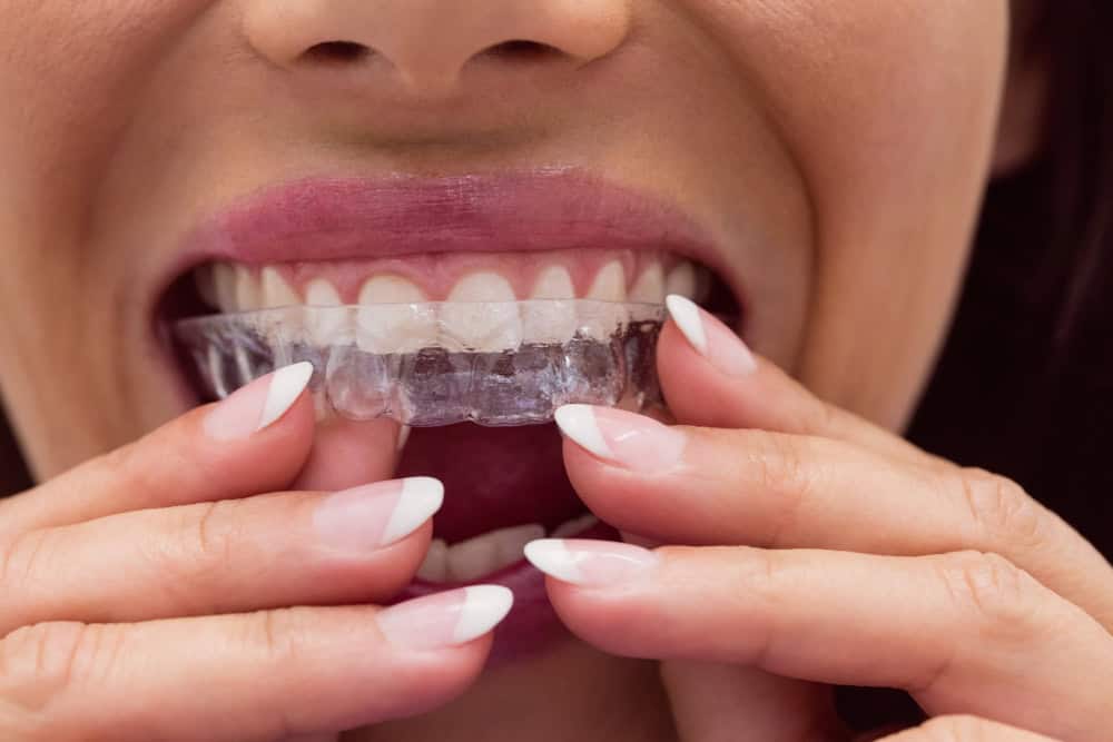 Dental cleaning and preventive care at Ember Dental, Deerfield Beach, FL